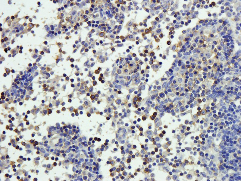 CD20 antibody