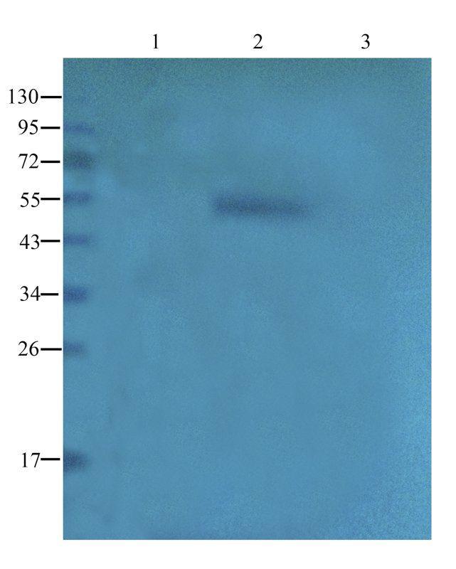 CD20 antibody