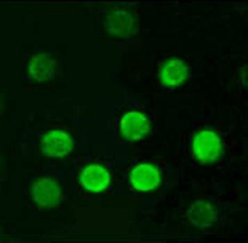 CD20 Antibody