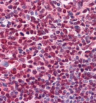 CD20 Antibody