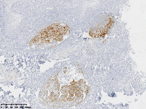 CD21 Antibody
