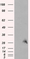 CD21 Antibody