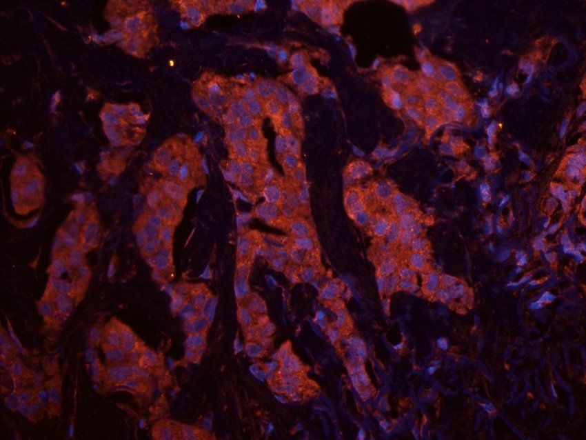 CD213a2 antibody