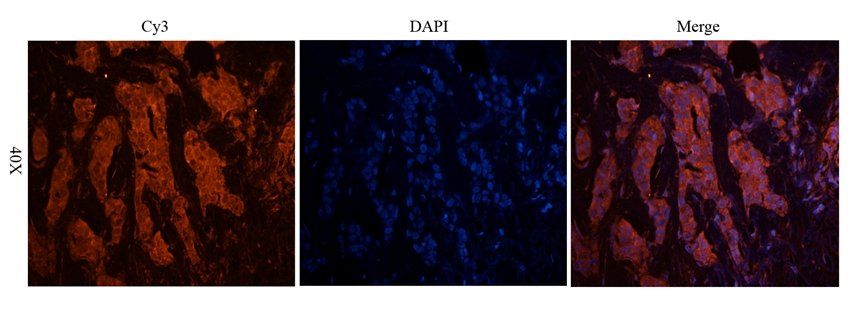 CD213a2 antibody