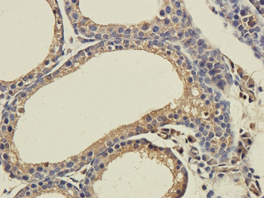 CD213a2 antibody