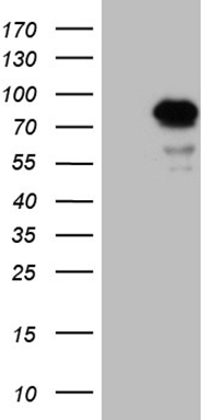 CD22 Antibody