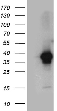 CD22 Antibody