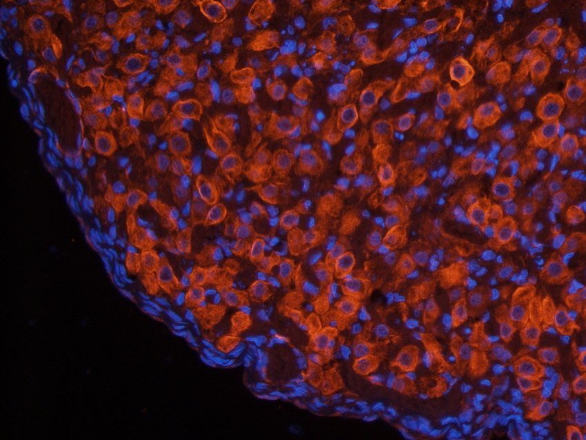 CD222 antibody