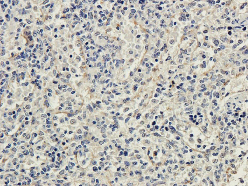 CD222 antibody