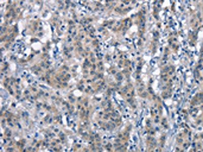 CD226 Antibody