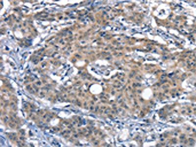 CD226 Antibody