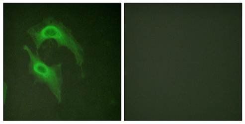 CD226/DNAM-1 (Ab-329) Antibody