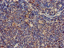 CD247 antibody