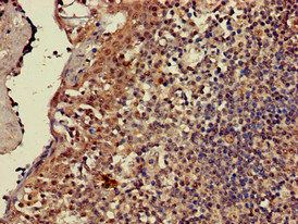 CD247 Antibody