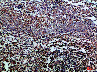 CD247 antibody