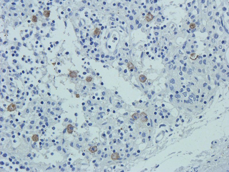 CD24 antibody