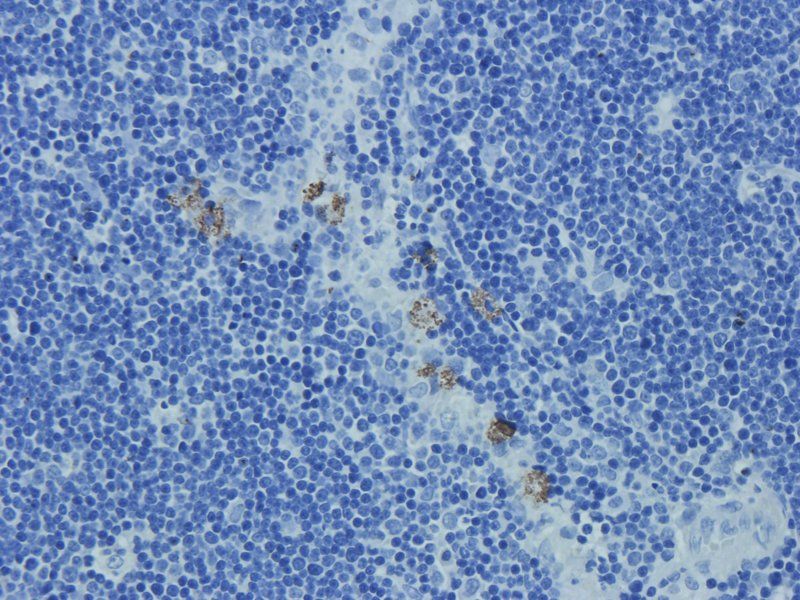 CD24 antibody