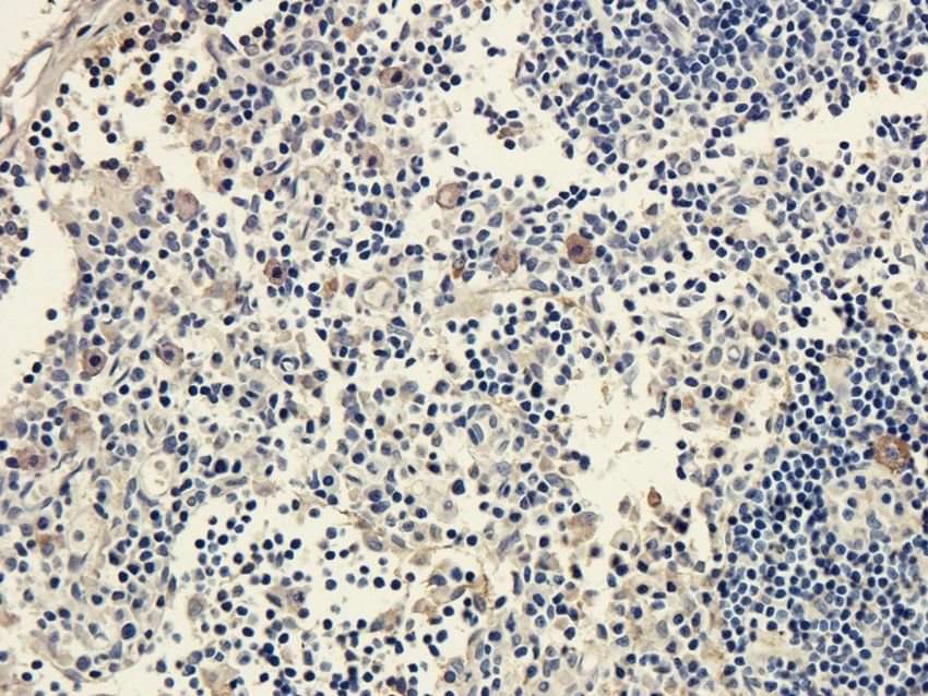 CD25 antibody