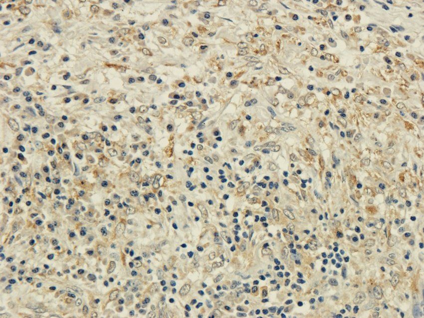 CD25 antibody