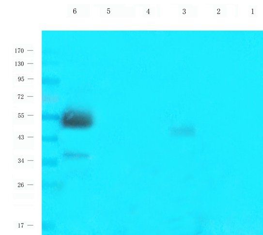 CD25 antibody