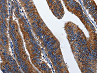 CD27 Antibody