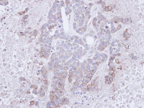 B and T lymphocyte associated Antibody