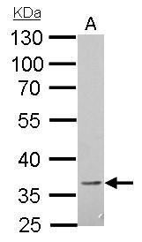 B and T lymphocyte associated Antibody