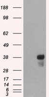 BTLA Antibody