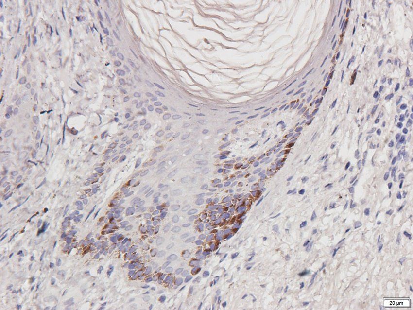 CD274 antibody