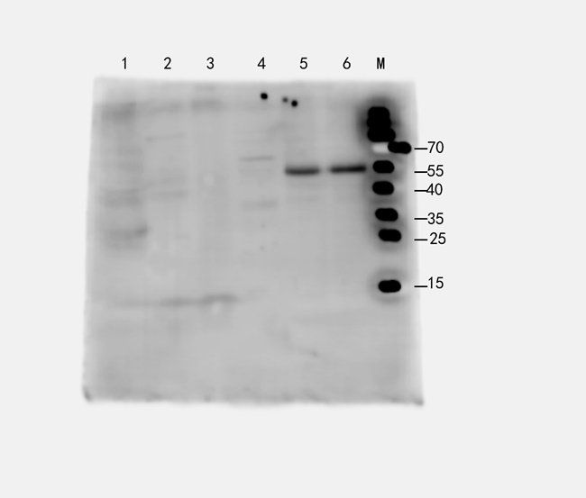 CD274 antibody