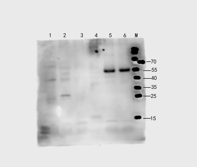 CD274 antibody