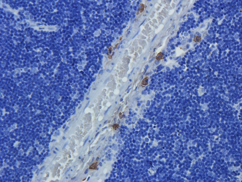 CD274 antibody