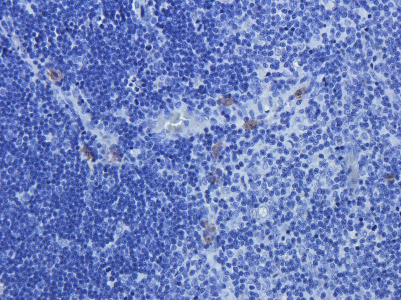 CD274 antibody