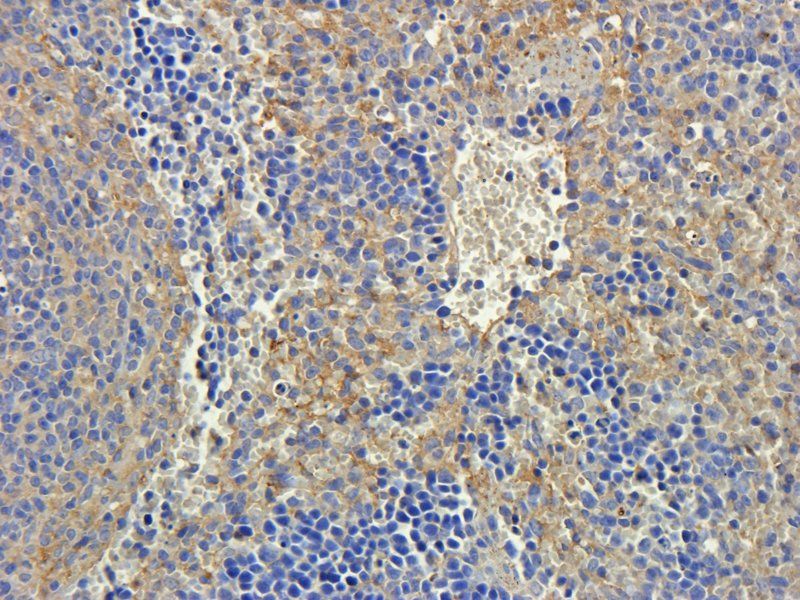 CD274 antibody