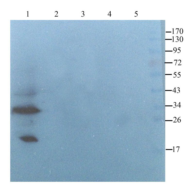 CD274 antibody