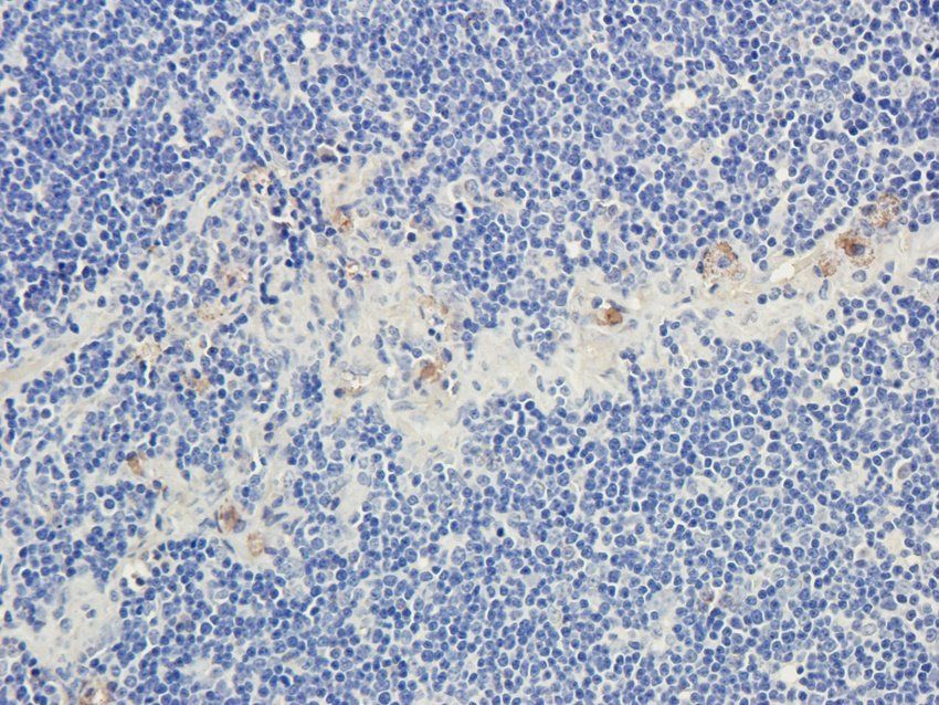 CD28 antibody