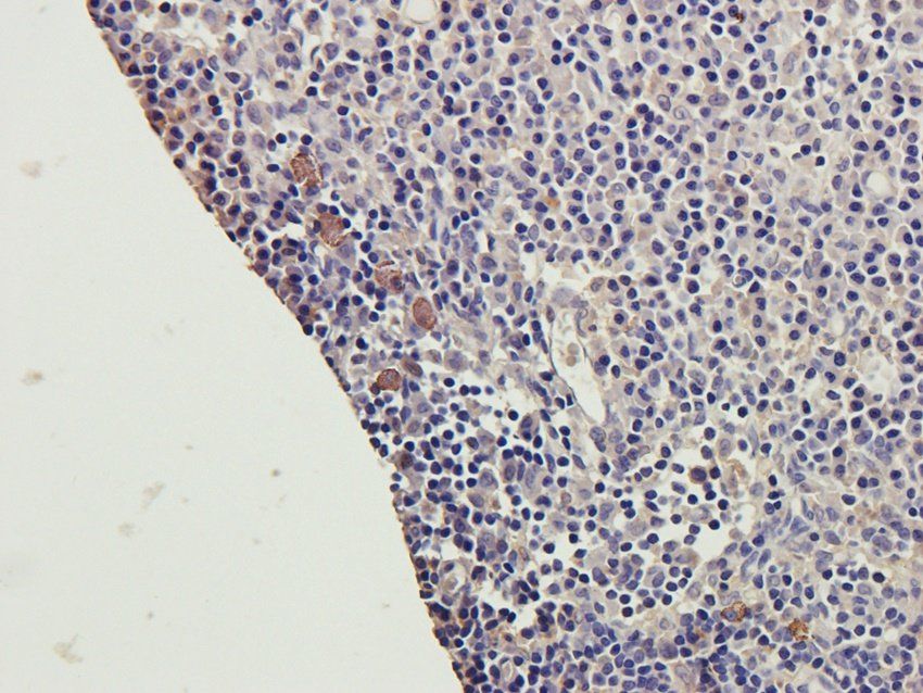 CD28 antibody