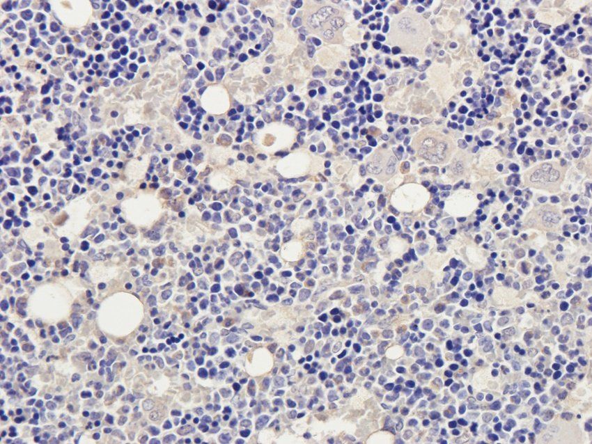 CD28 antibody