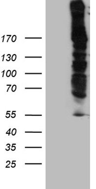 CD30 Antibody