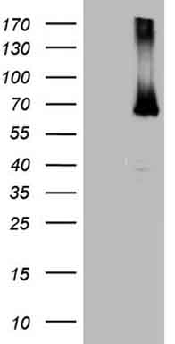 CD30 Antibody