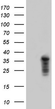CD30 Antibody