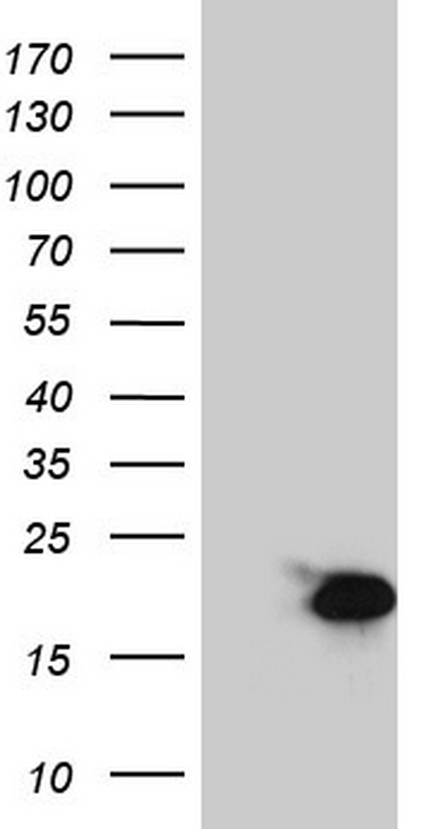 CD30 Antibody