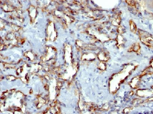 CD31 / PECAM-1 (Endothelial Cell Marker) Antibody