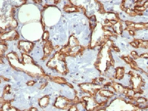 CD31 / PECAM-1 (Endothelial Cell Marker) Antibody