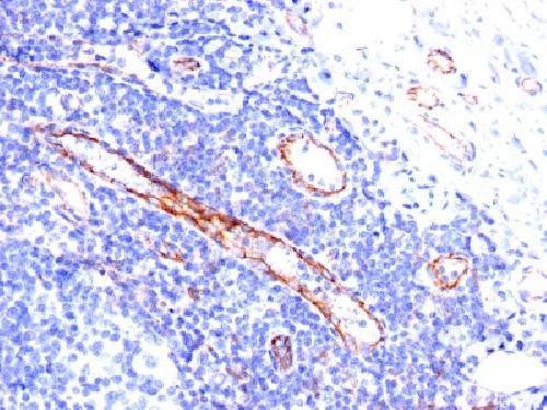 CD31 / PECAM-1 (Endothelial Cell Marker) Antibody