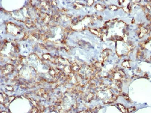 CD31 / PECAM-1 (Endothelial Cell Marker) Antibody