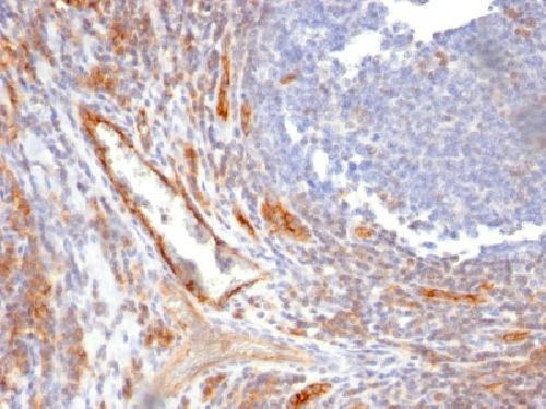 CD31 / PECAM-1 (Endothelial Cell Marker) Antibody