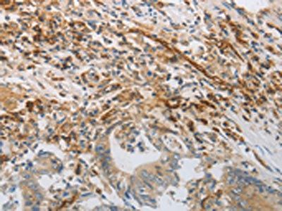 PECAM1 Antibody