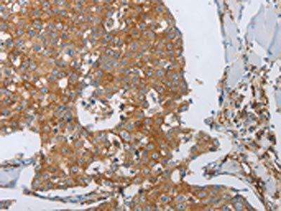 PECAM1 Antibody