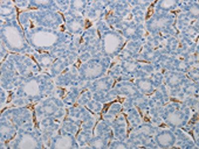 PECAM1 Antibody